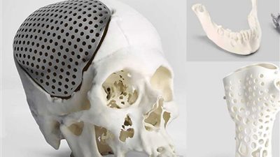 خطوة رائدة في الطب التجميلي.. أول زراعة لأنسجة مطبوعة بتقنية ثلاثية الأبعاد