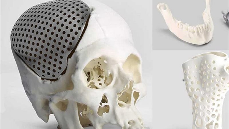 خطوة رائدة في الطب