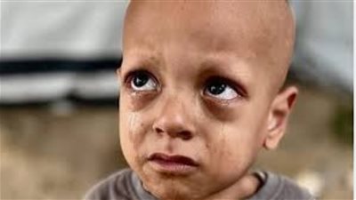 وفاة الطفل الفلسطيني «عبد الله أبو زرقة» صاحب عبارة «أنا جعان»