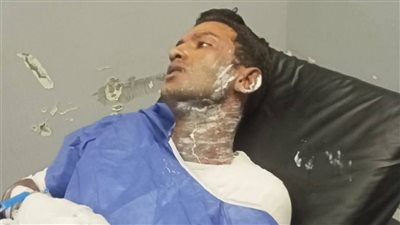 حلم الزواج تحول إلى كابوس ..احترقت شقة العريس و اكلت النيران جسده 