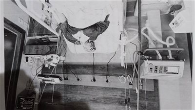 النيابة تنهي مناظرة جثمان «عروسة حلوان» بعد وفاتها إثر عملية حقن بالوجه