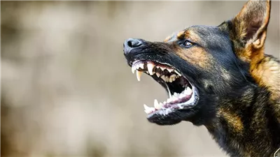 مصرع طفلة عقرها كلب داخل كمبوند بمدينة أكتوبر          