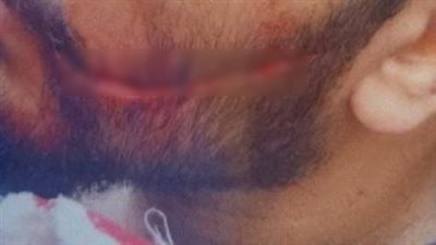 مشرط في وجه الطبيب.. مأساة داخل مستشفى سيد جلال | تفاصيل 