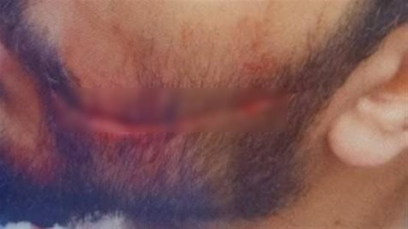 إصابة طبيب امتياز