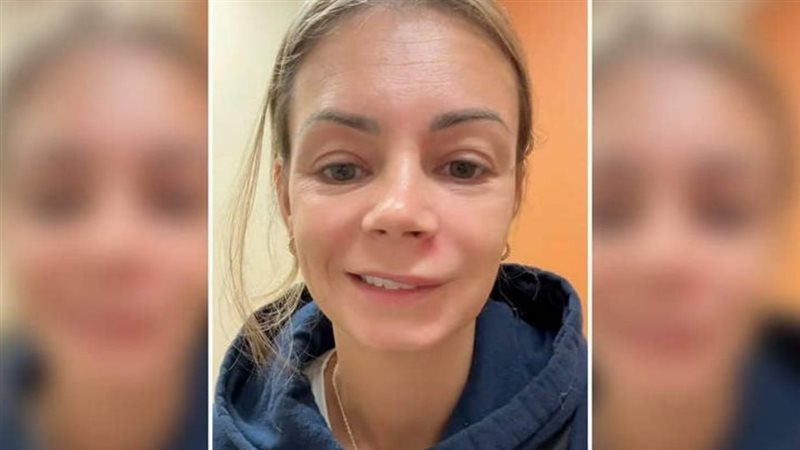 المرأة صاحبة الواقعة