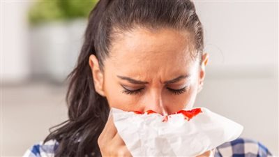 نزيف الأنف أسبابه الشائعة والخطيرة وطرق العلاج والوقاية 
