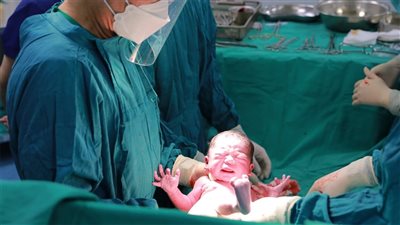 «الصحة»: مصر تسجل أعلى معدلات ولادة قيصرية في العالم | فيديو 