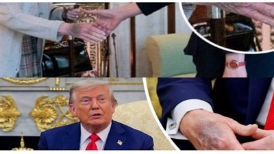 هل يواجه ترامب مصير ملكة بريطانيا قبل وفاتها ؟.. كدمات اليد تثير مخاوف