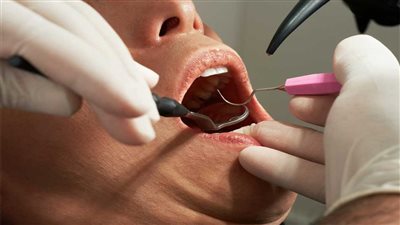 ما حكم زكاة عيادات الأسنان وما كيفيتها؟.. الإفتاء توضح 