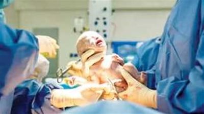 ما هو البارتوجرام (Partograph) ؟ بعد بيان وزارة الصحة والسكان الأخير