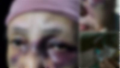 الأمن يكشف ملابسات واقعة اعتداء شخص على والدة زوجته بشبرا الخيمة 