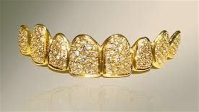 ما حكم عمل تركيبات الأسنان من الذهب والفضة والبلاتين؟