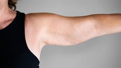 بدون عمليات جراحية.. طرق علاج الترهلات بعد تكميم المعدة