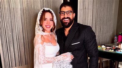 تأكيدًا لـ «نيوز رووم».. مدير أعمال رنا رئيس يكشف تفاصيل تعرضها لنزيف