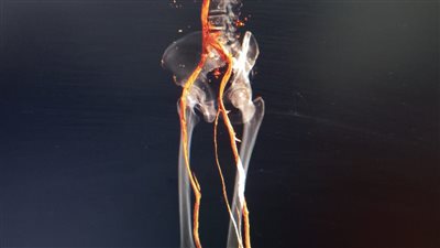  إنجازات جديدة بقسم الأشعة في مستشفى منوف العام.. فحوصات متقدمة لخدمة المرضى