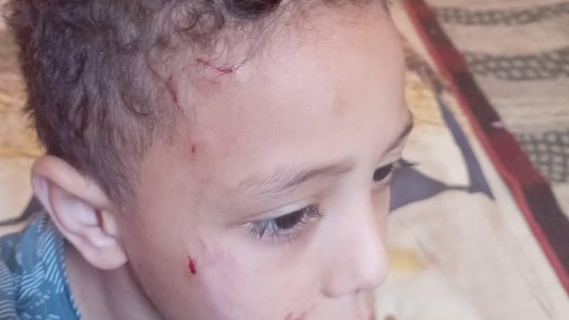 الكلاب تهدد الاطفال