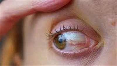 الشمر واللوز قبل النوم.. وصفة طبيعية تعزز صحة العين وتقي من الأمراض