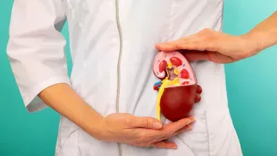 لمنع تكرار تكون حصوات الكلى.. أطعمة عليك تجنبها لصحتك 