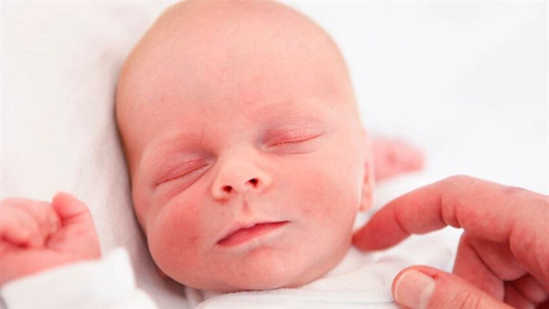  لون خدود الطفل أحمر