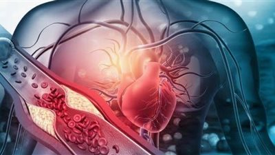 5 عادات يومية خفية قد ترفع خطر الإصابة بالنوبات القلبية 	