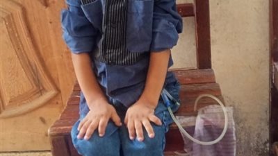 طفل البحيرة يستغيث: «نفسي أخف وأعيش زي باقي أصحابي»