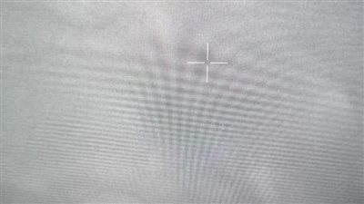 نجاح التشغيل التجريبي لجهاز تفتيت حصوات الكلى بمستشفى دمياط العام