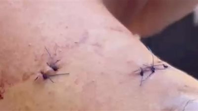  إصابة طالب بطعنات متفرقة على يد 5 شباب أمام مدرسة في الدقهلية