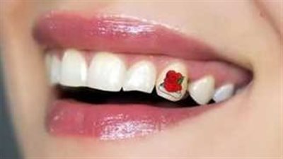 تاتو الأسنان.. تريند صيني جديد يتفوق على 