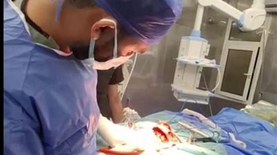 تدخل جراحي ينقذ طفل بعد اختراق مسمار لجمجمته بمستشفى دمياط العام