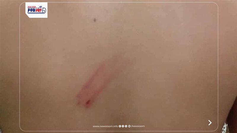واقعة الضرب