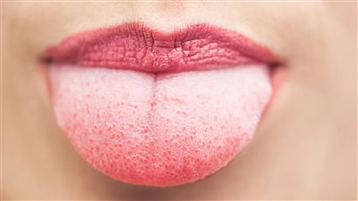 اللون والطبقة يكشفا الكثير.. ماذا يقول لسانك عن صحتك؟