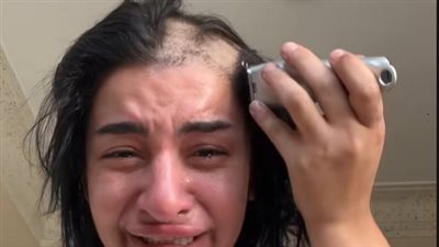 البلوجر بطة ضياء تحلق شعرها بالكامل وتنهار بالبكاء على تيك توك دون تفسير (صور)