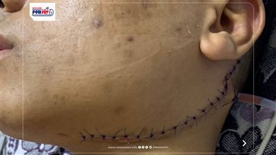 أبطال العمليات بالفيوم العام ينقذون شابا من الموت بعد إصابته بجرح قطعي بالرقبة