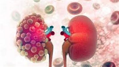 3 عناصر غذائية تحمي الكلى من الفشل.. توصيات طبية جديدة