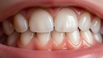 نصائح للأمهات.. بداية تنظيف أسنان طفلك وكيفية اختيار معجون الأسنان؟