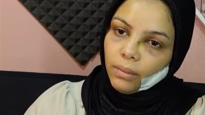 ثلاث سنوات من العذاب.. قصة مأساوية لزوجة تعرضت للتعذيب والتشويه في بولاق