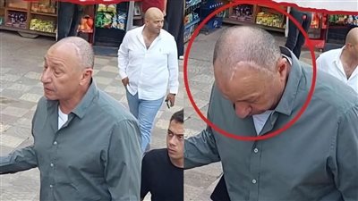 بملامح متعبة وأثر جرح في رأسه.. أزمات صحية خطيرة واجهها محمود الخطيب