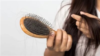 تساقط الشعر أو الصلع: تعرفي ما هي أضرار الشعر المستعار   ؟