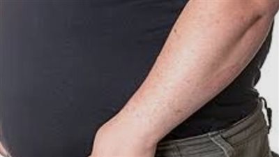 اكتشاف جديد يفسر علاقة السمنة بارتفاع خطر الإصابة بالزهايمر 	