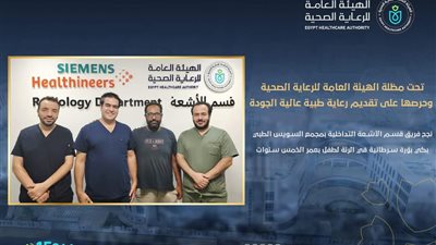 إجراء أول عملية كي حراري لبؤرة سرطانية في الرئة بمجمع السويس الطبي