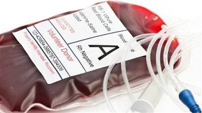 لأول مرة.. زرع كلية معدلة بفصيلة دم 