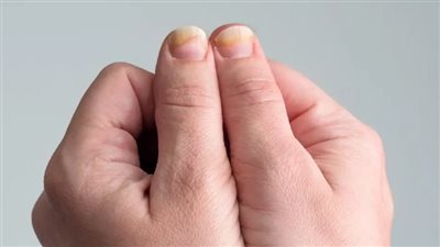 تغير شكل الأظافر.. علامات تحذيرية تستدعي زيارة الطبيب