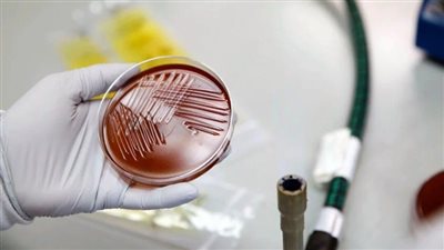 آخر أخبار الصحة.. تطوير أول فحص دم للكشف عن متلازمة التعب المزمن