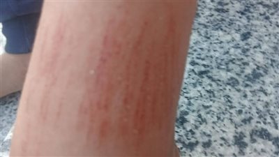 بسبب ضرب طالب.. استبعاد مدير مدرسة ومعلمة بعد اعتدائها على تلميذ في طوخ