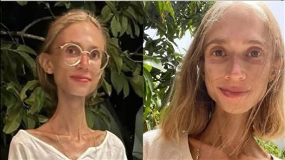 نباتية متطرفة.. وفاة مؤثرة شهيرة بسبب نظام غذائي صارم