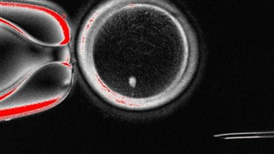 إنجاز غير مسبوق... علماء يحولون خلايا الجلد إلى بويضات قابلة للإخصاب