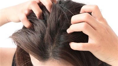 التهاب بصيلات الشعر في فروة الرأس.. الأسباب والأعراض والعلاج