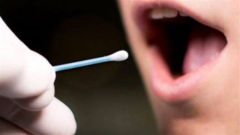  فطريات الفم