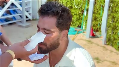 أثناء تصوير فيلم نصيب.. معتصم النهار يتعرض إلي إصابة في الوجه