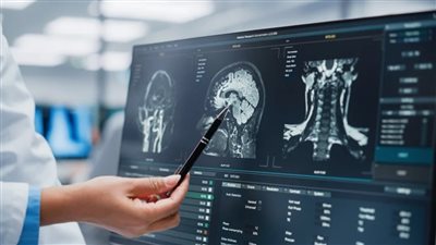 إزالة المبيضين له تكلفة عالية على الدماغ.. ما الأمر؟